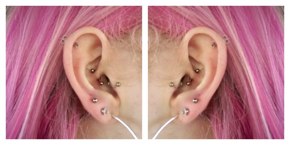 daith piercing for migraines
