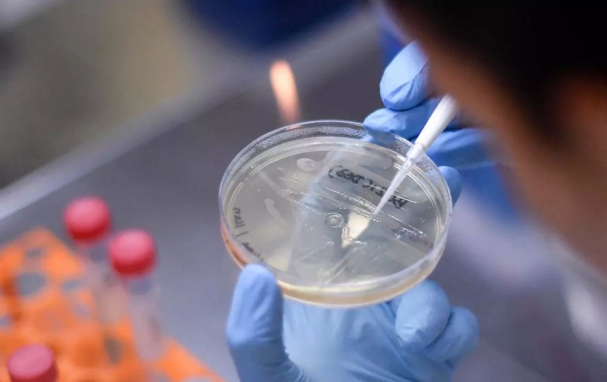 Coronavirus en Argentina: Con 80 nuevos casos, el total de infectados en el país asciende a 1.795, con 65 muertos Coronavirus en Argentina: Con 80 nuevos casos, el total de infectados en el país asciende a 1.795, con 65 muertos