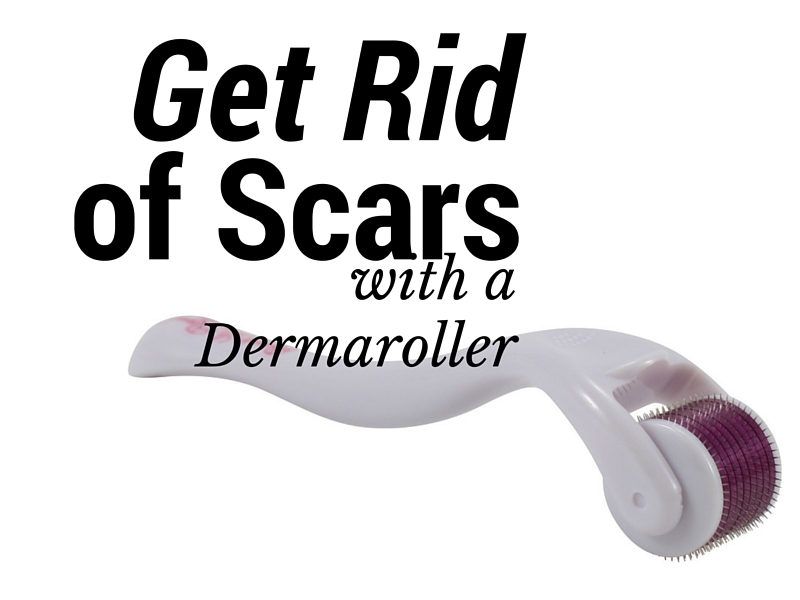 Remove Acne Scars On Face Naturally Remove Acne Scars On Face Naturally