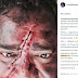 FAMOSOS / Compadre Washington posta foto com marca de ferimento no rosto e choca fãs