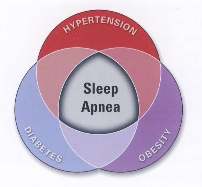 Sleep and Neurology: Obstructive Sleep Apnea 101: The Main Facts