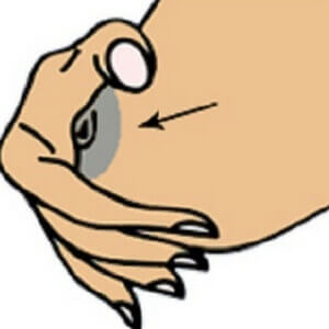 أعراض الحمل  أعراض الحمل