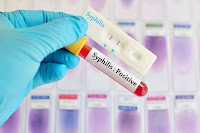 5 Obat Sipilis pada Pria Paling Ampuh di Apotek Umum