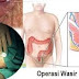 Obat Wasir Ambeven thumbnail