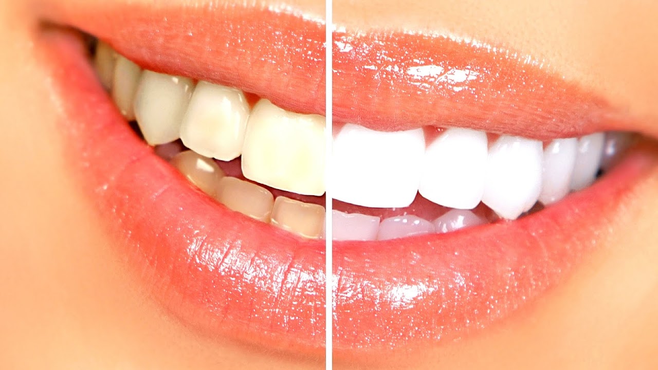 dentists-open-on-sundays-near-me-sunday-choices