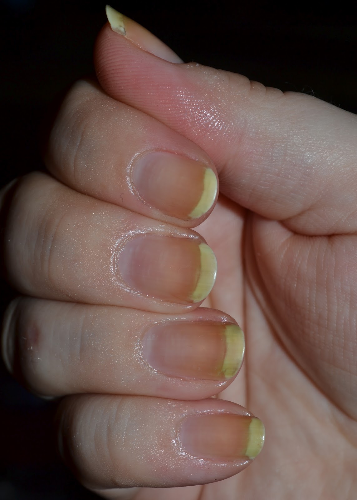 Hap Hap Happy Hands: Nail Care: Cuticle Remover