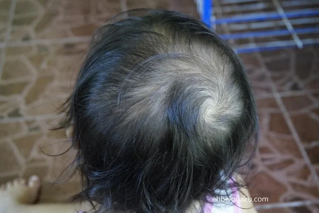 botak,rambut nipis,rambut anak botak