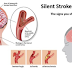 One Month Before Stroke, Your Body Will Send You These Warning Signs