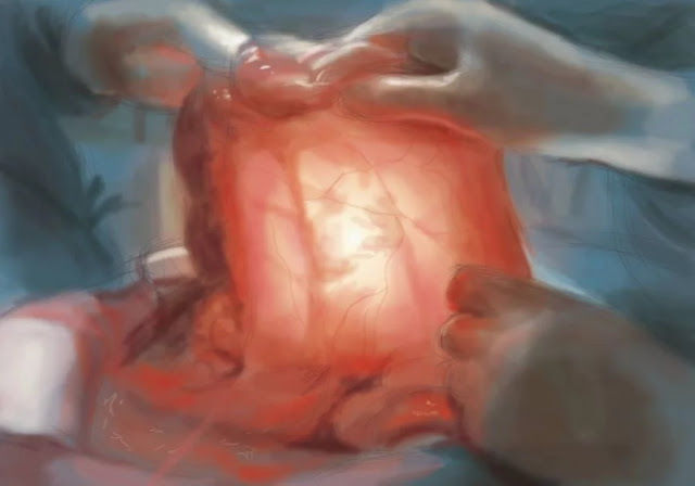 Apa itu Organ Mesentery? Apa itu Organ Mesentery?, Penjelasan Organ Mesentry Manusia, Fungsi dari Organ Mesentry Manusia, Letak Mesentry di Tubuh manusia.