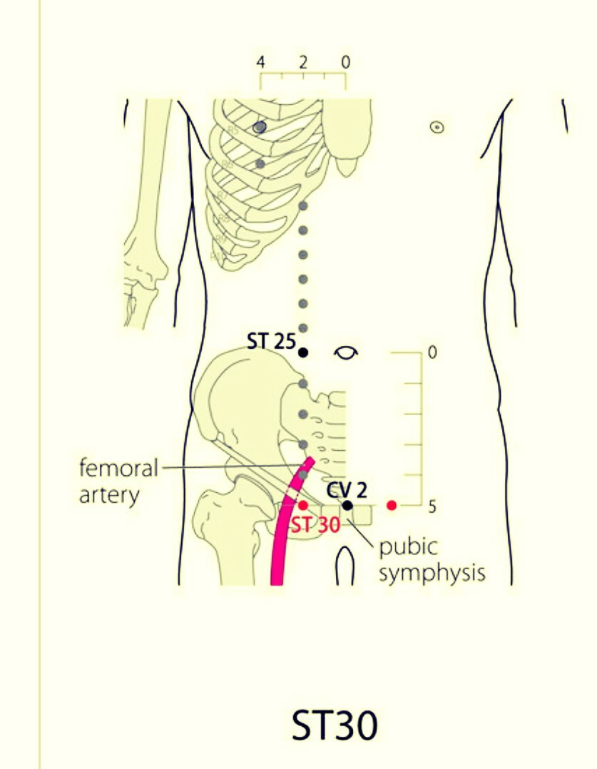 SaroEpic Acupuncture Acupuncture Points for Polycystic