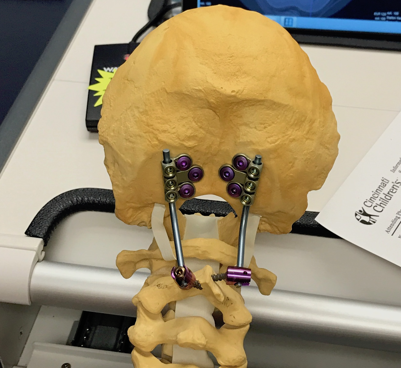 Living the Chronically Wonderful Life POTS, EDS, gastroparesis, and Chiari Loose