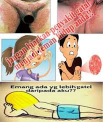 Tips Mengatasi Gatal Di Selangkangan dan pantat Secara Alami
