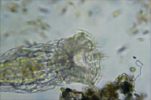 PrionicProtein: Rotíferos