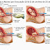 Aborto: Levando a Vida Seriamente
