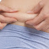 Liposuction Sonrası Kilo Alınırsa Ne olur?