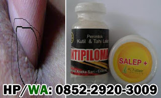 Bukti Barang Sampai Real Asli Obat Kutil Kelamin Bukti Barang Sampai Real Asli Obat Kutil Kelamin