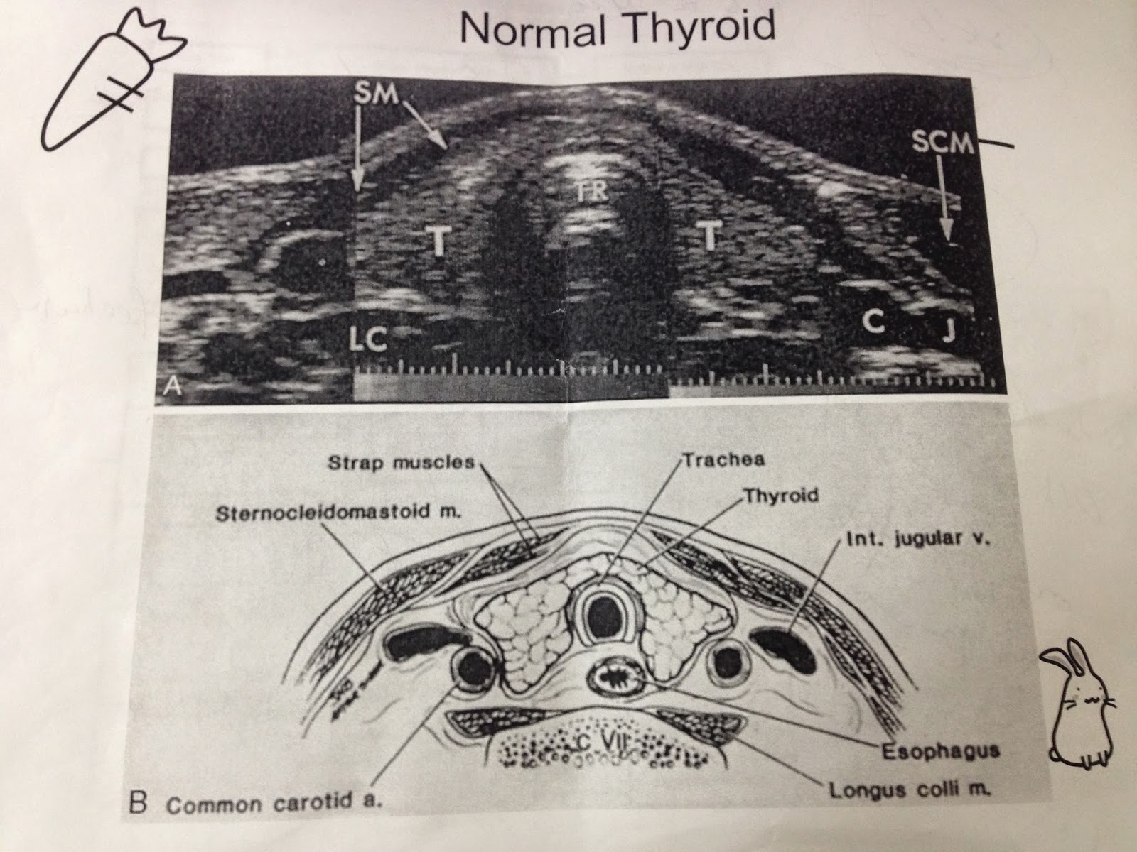 Taiwan Global Health Internship: Anny Xiao Week 4 Endocrinology Day 3 & 4