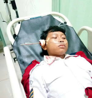 Masuk Sekolah Siswa SMK Terkena Anak Panah Masuk Sekolah Siswa SMK Terkena Anak Panah