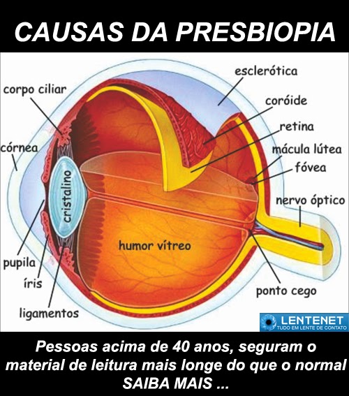 Lente de Contato Setembro 2014