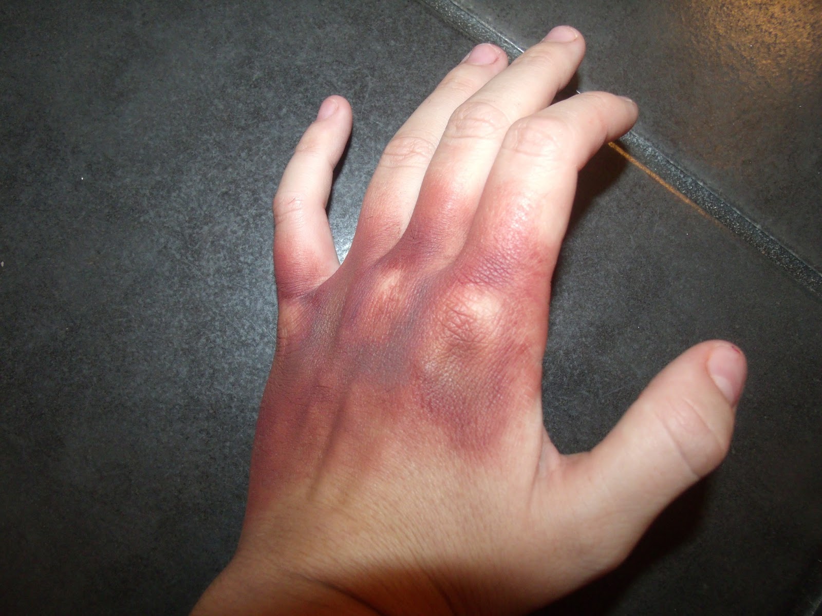 Meesha Spurr, Make-up Artist.: Burns,cuts and bruise looks/ pictures