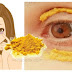 SHE STARTED APPLYING TURMERIC AROUND HER EYES 10 MINUTES LATER THE RESULTS WERE INCREDIBLE