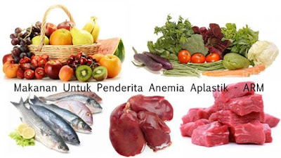 http://arumherbal30.blogspot.co.id/2018/01/makanan-untuk-penderita-anemia-aplastik.html