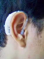 alat bantu dengar bisa ditanggung bpjs