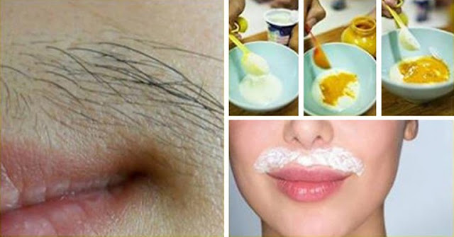 1 REMEDIO NATURAL PARA DESHACERSE DE PELO DEL LABIO SUPERIOR DE FORMA PERMANENTE 1 REMEDIO NATURAL PARA DESHACERSE DE PELO DEL LABIO SUPERIOR DE FORMA PERMANENTE
