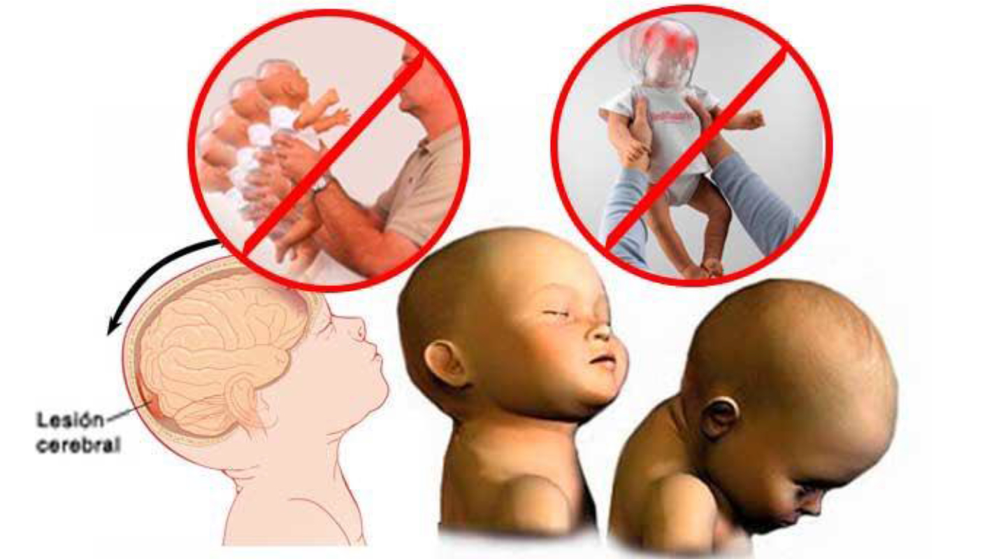 El blog de APSA sobre infancia y adolescencia SÍNDROME DEL BEBÉ