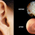 THE EASIEST METHOD TO CLEAN YOUR EARS NATURALLY!