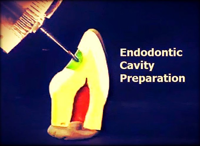 ENDODONTIC Cavity Preparation - University of Michigan