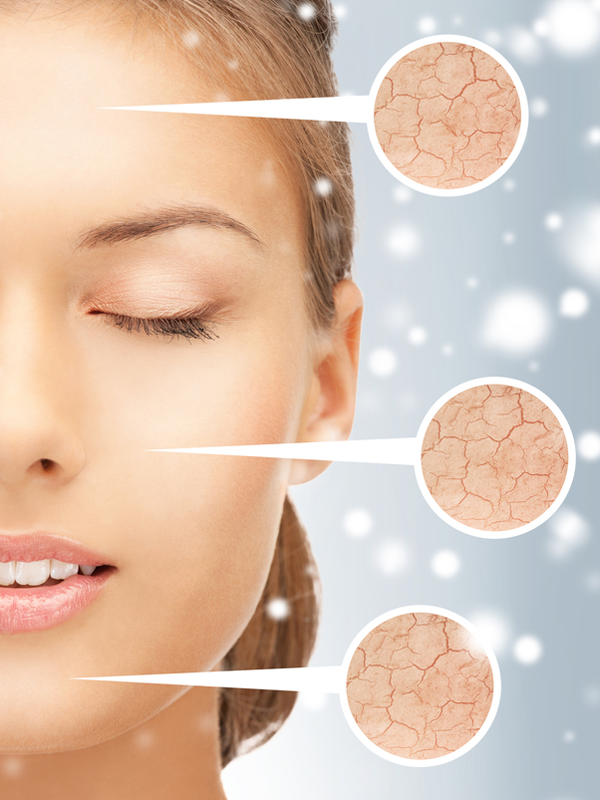 10 Ways to Protect Your Skin from Winter Dryness {enjoy the view}