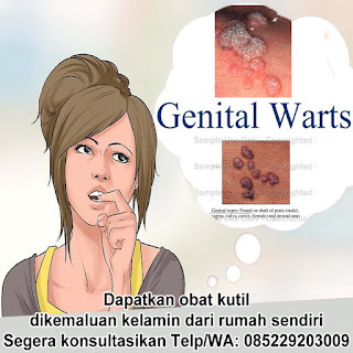 Obat kutil kelamin