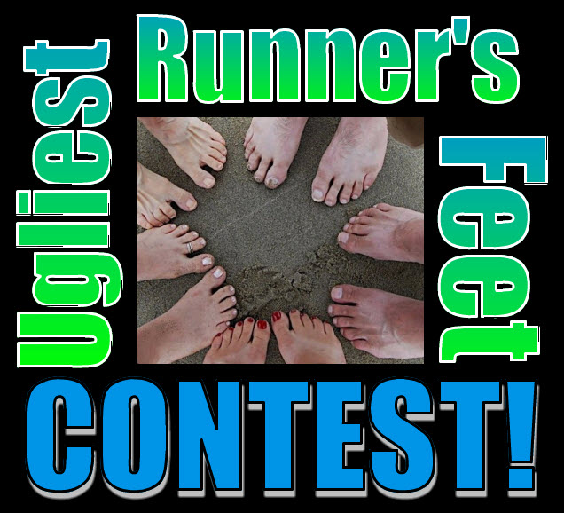 RunnerDude's Blog Ugliest Runner's Feet Contest!