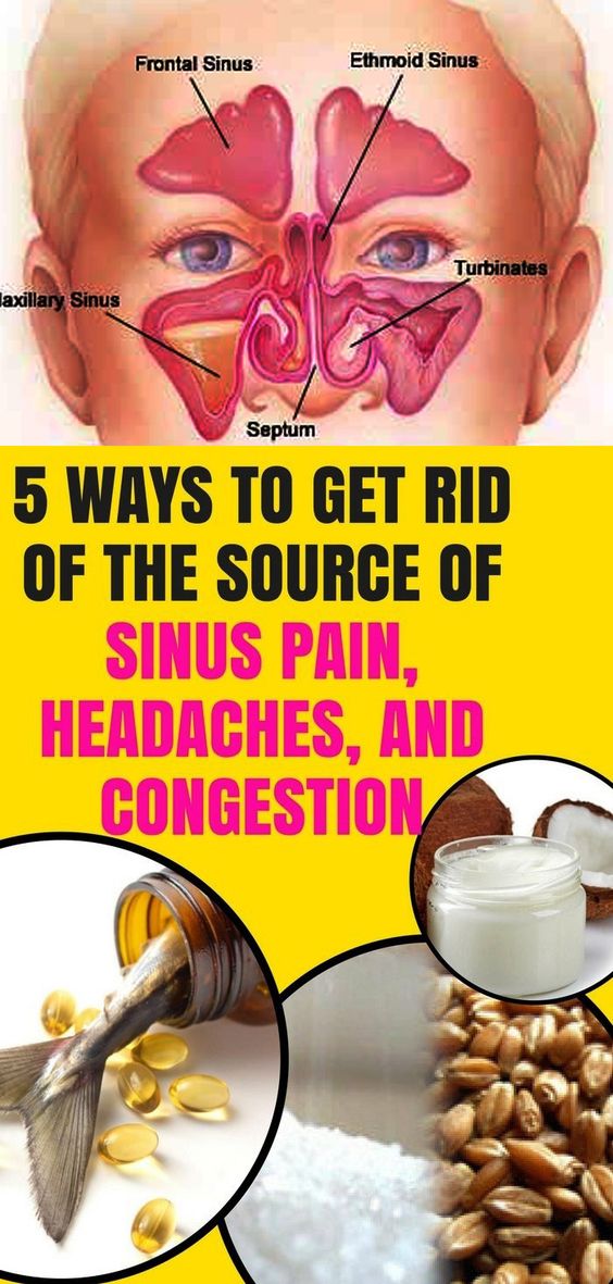 here-are-5-ways-to-get-rid-of-the-source-of-sinus-pain-headaches
