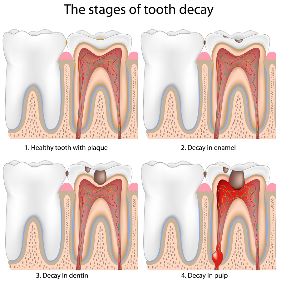 Dental Dialogue Fact or Fiction If your teeth don't hurt there's