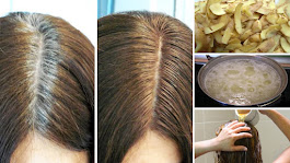 Potato Peel – The Best Way To Get Rid Of Gray Hair! Here Is How!