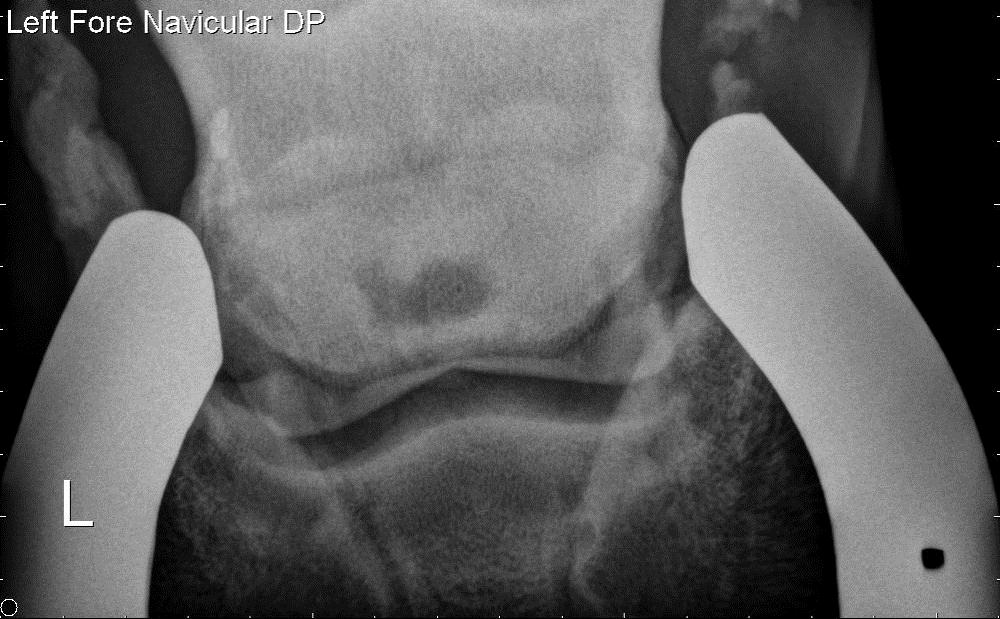 Michael Porter, Equine Veterinarian Navicular bone cyst in sound horse!