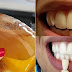 Gargle This Liquid Every Day And See What Happens To Your Teeth