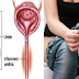4 Natural Ingredients Can Help To Cure Your Urinary Tract Infections (UTI) Rapidly