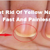 Get Rid Of Yellow Nails Fast And Painless!