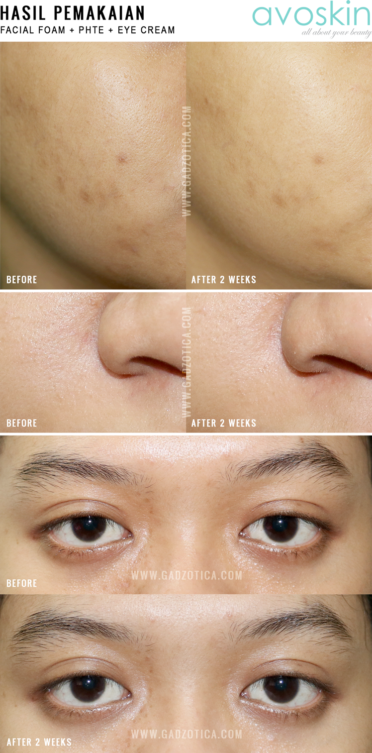 review eye serum avoskin