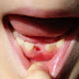 MÉDICOS ESTÃO IMPLORANDO PARA OS PAIS GUARDAREM O DENTE DE LEITE DOS SEUS FILHOS E A RAZÃO É SURPREENDENTE