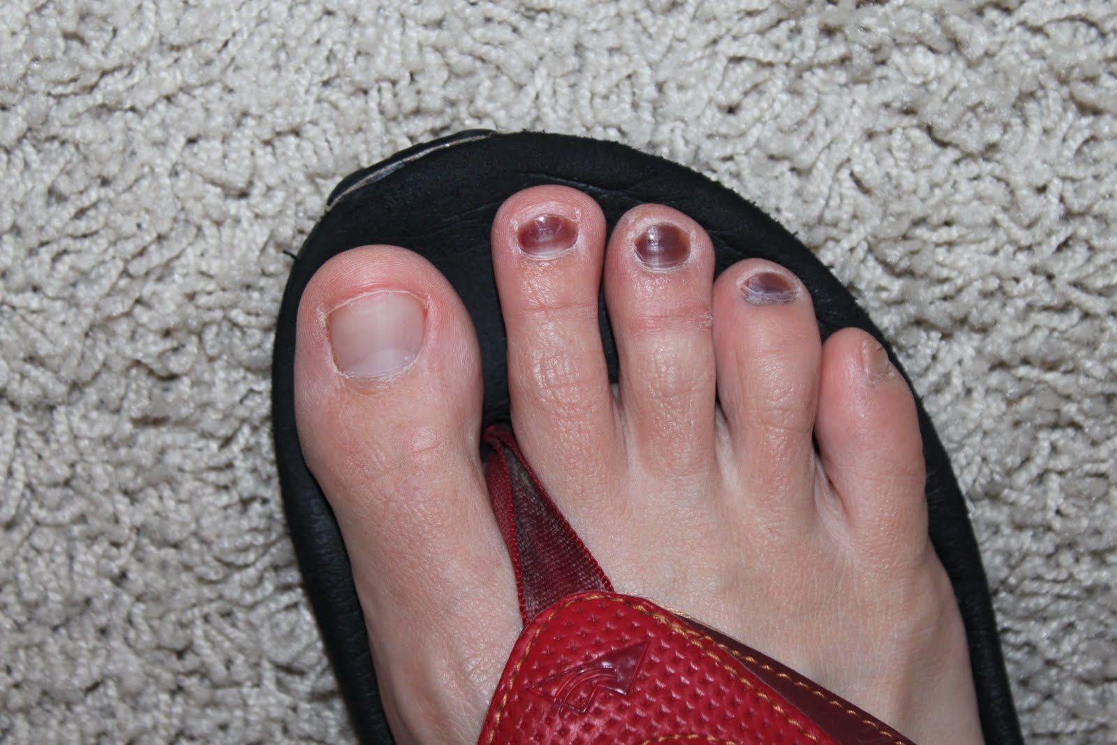 real vs fake black toe 1