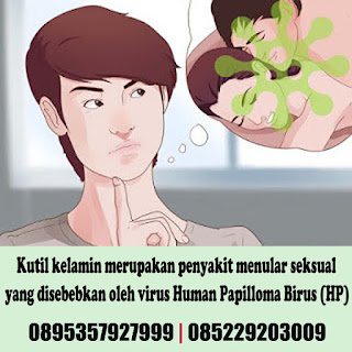 Obat Kutil Kelamin