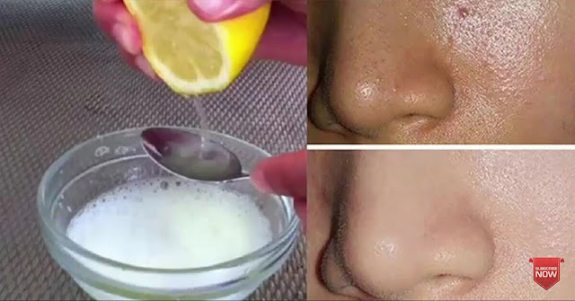 Cara mempersiapkan kosmetik lemon