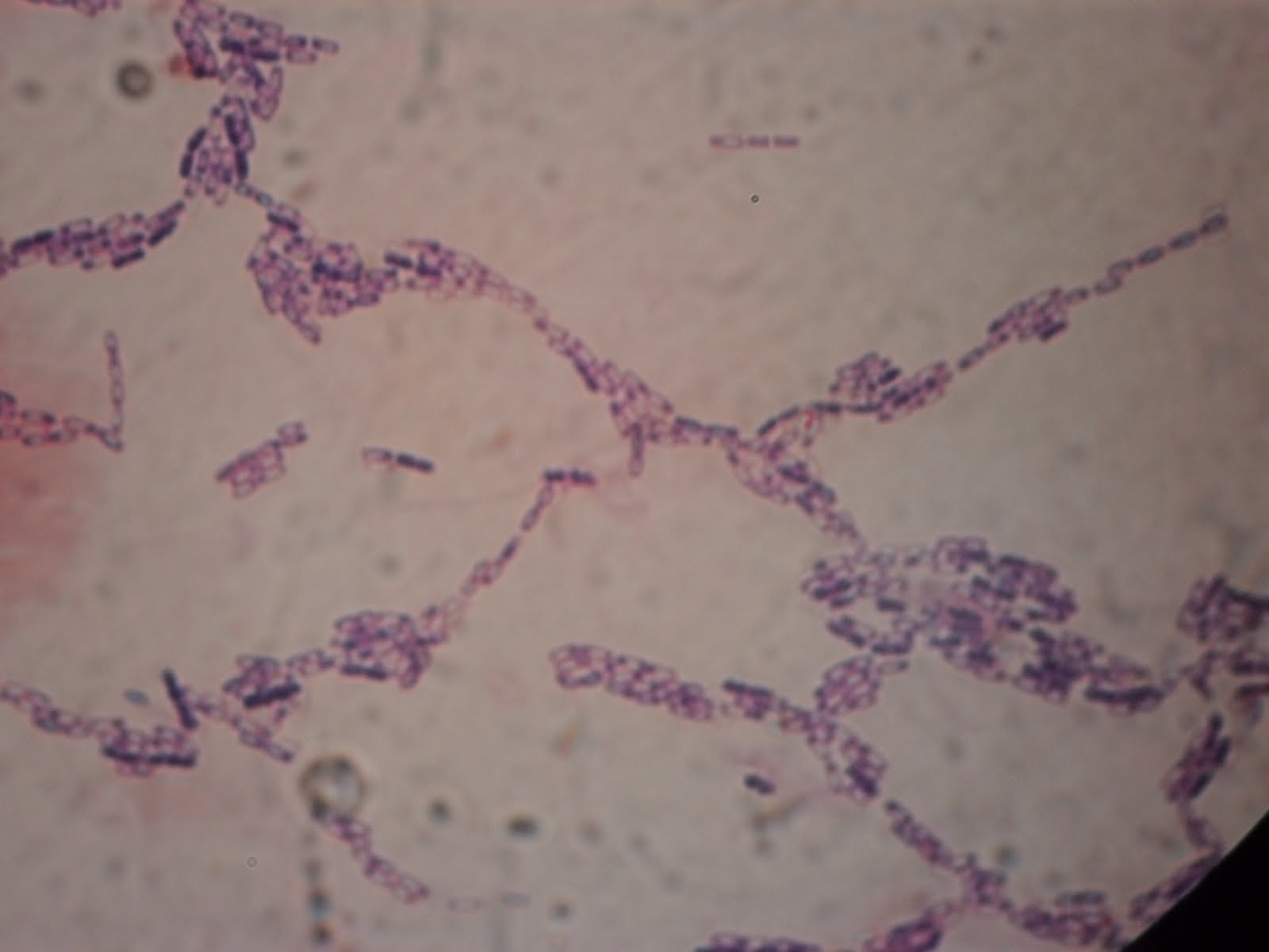 punya qhi qhie�s Blog: PEWARNAAN BAKTERI