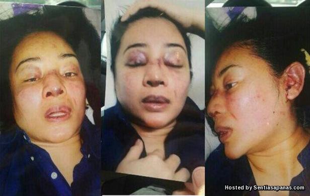 'Sila Cari Di Google, Hidung Dia Senget Atau Lurus?' Hidung+Rozanna