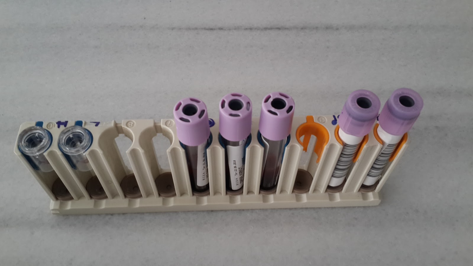 LABORATUVAR CİHAZLARI KULLANIM KILAVUZU : ARKRAY ADAMS A1c Laboratuvar ...