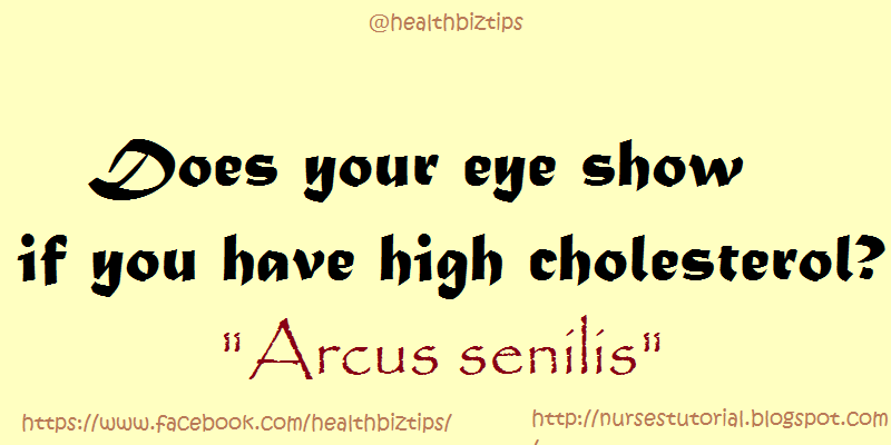Does your eye show if you have high cholesterol?